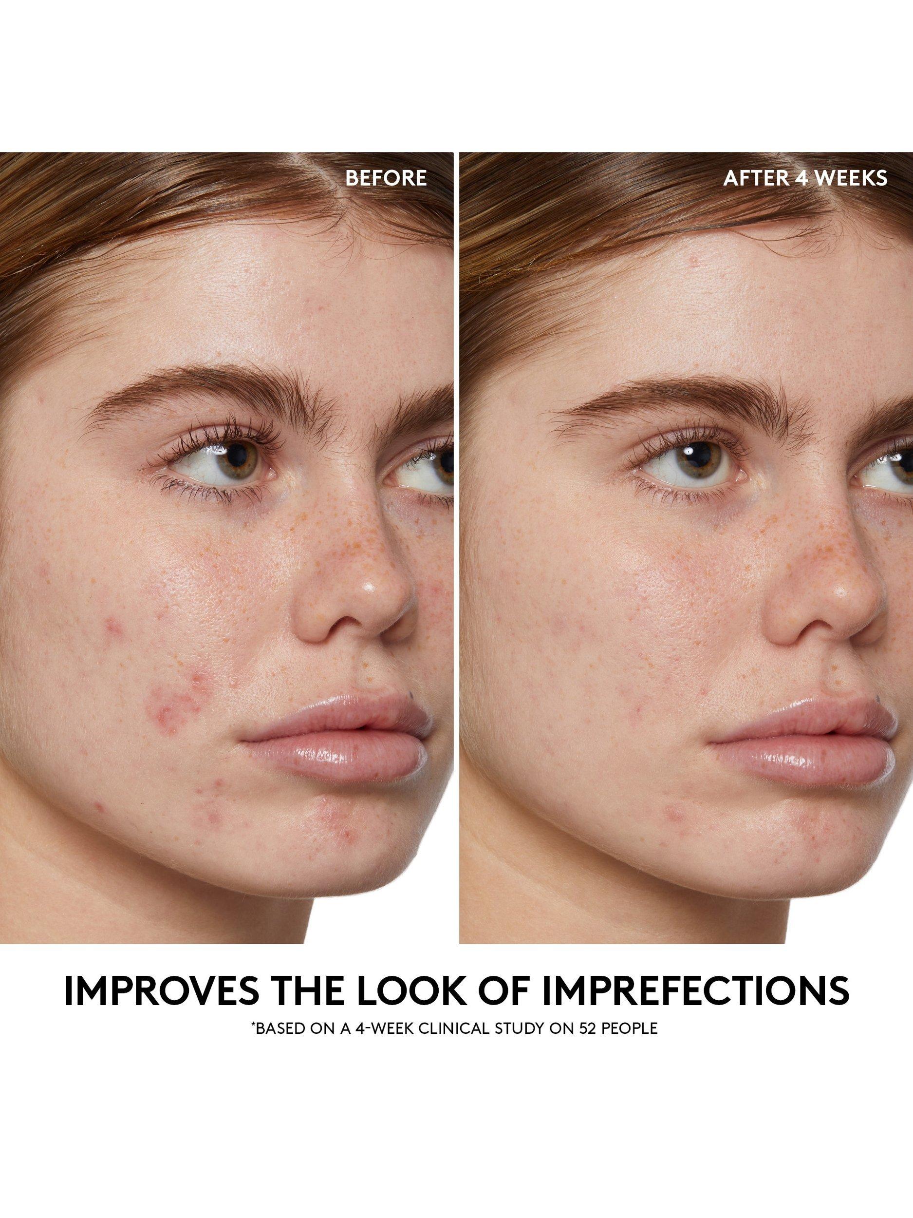 Product image 4 of 6, which shows Fenty Skin Cherry Dub BHA Toner, 150ml