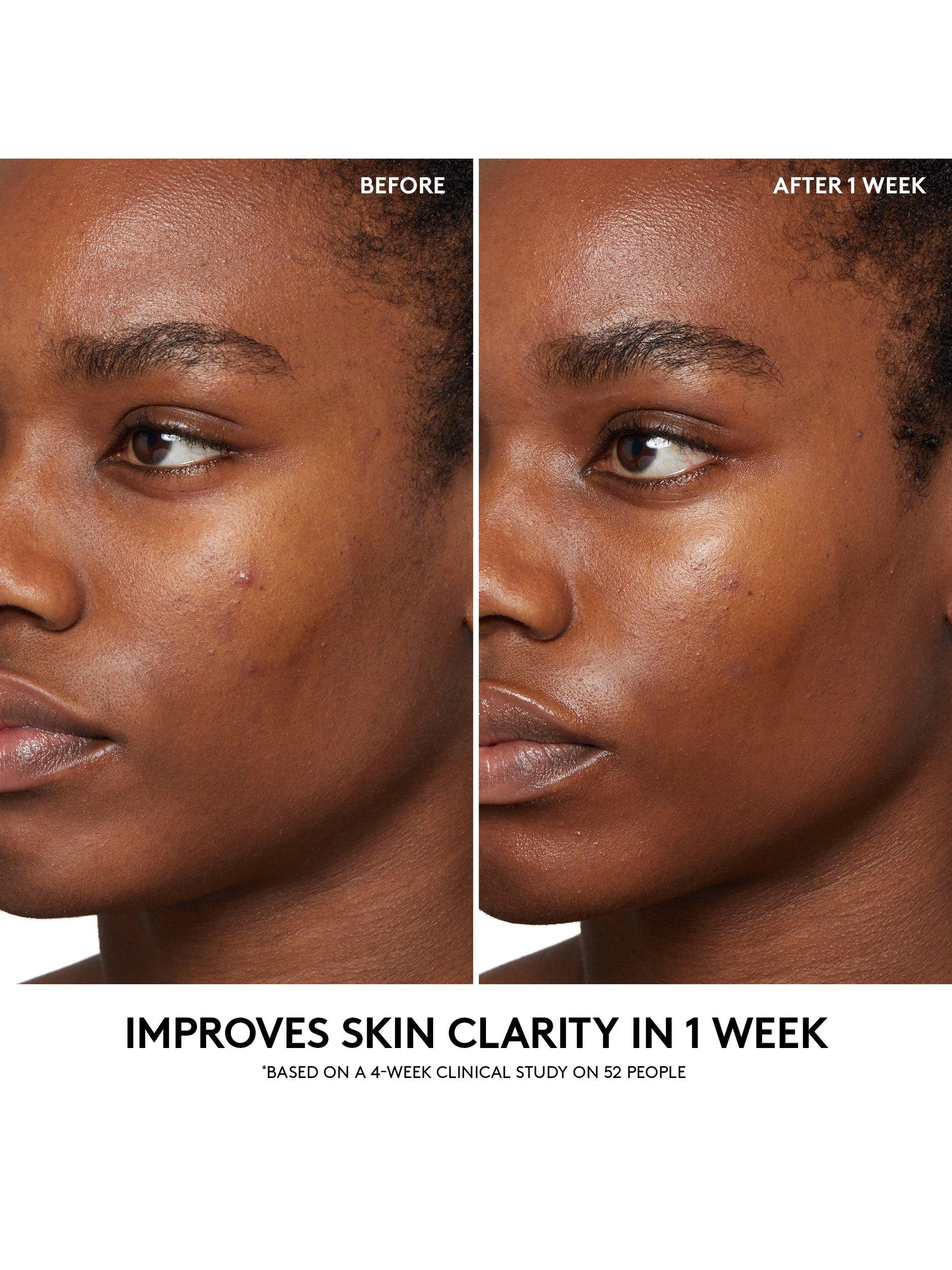 Product image 5 of 6, which shows Fenty Skin Cherry Dub BHA Toner, 150ml