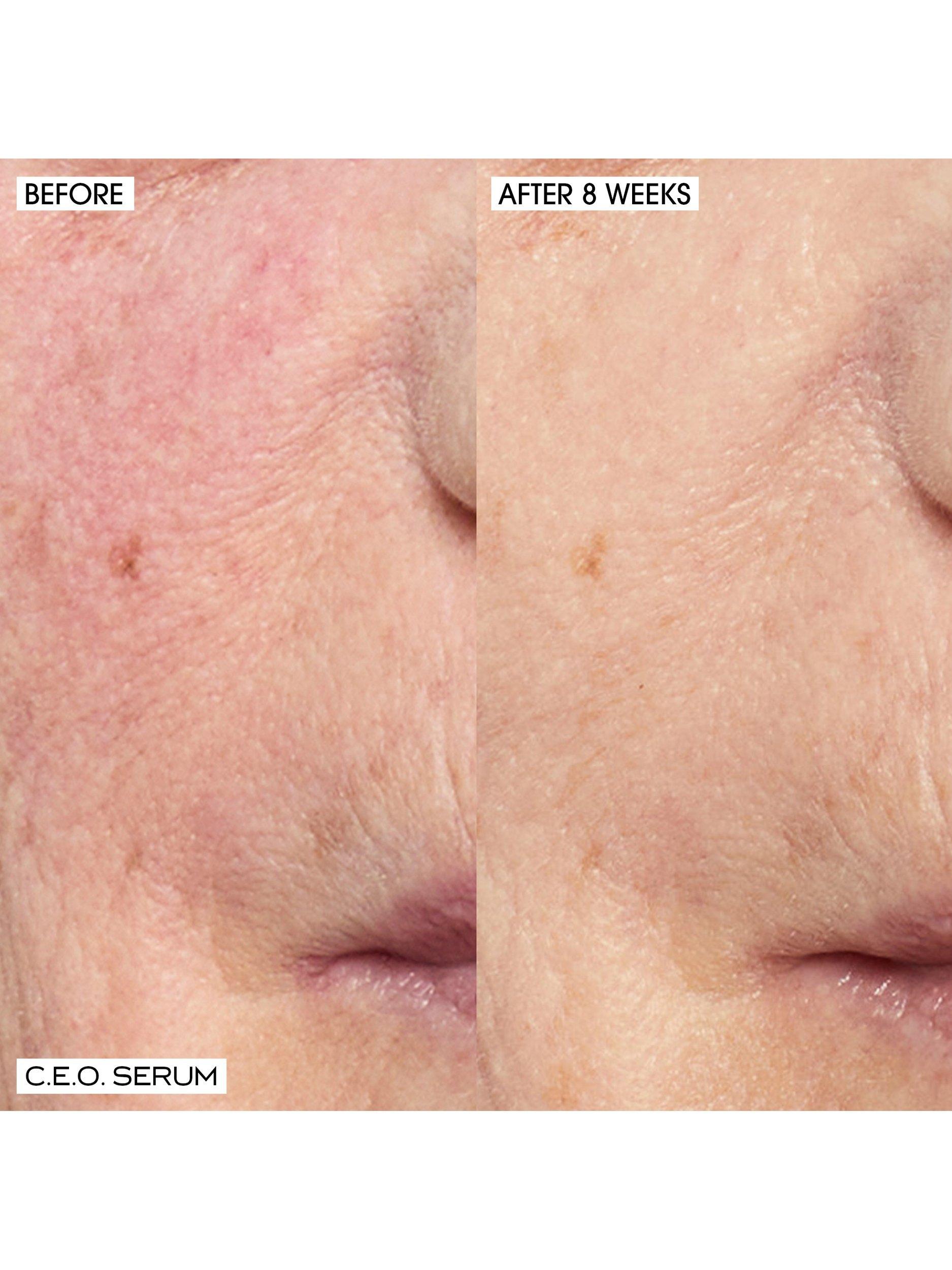 Product image 4 of 7, which shows Sunday Riley Glow Goals Skincare Gift Set