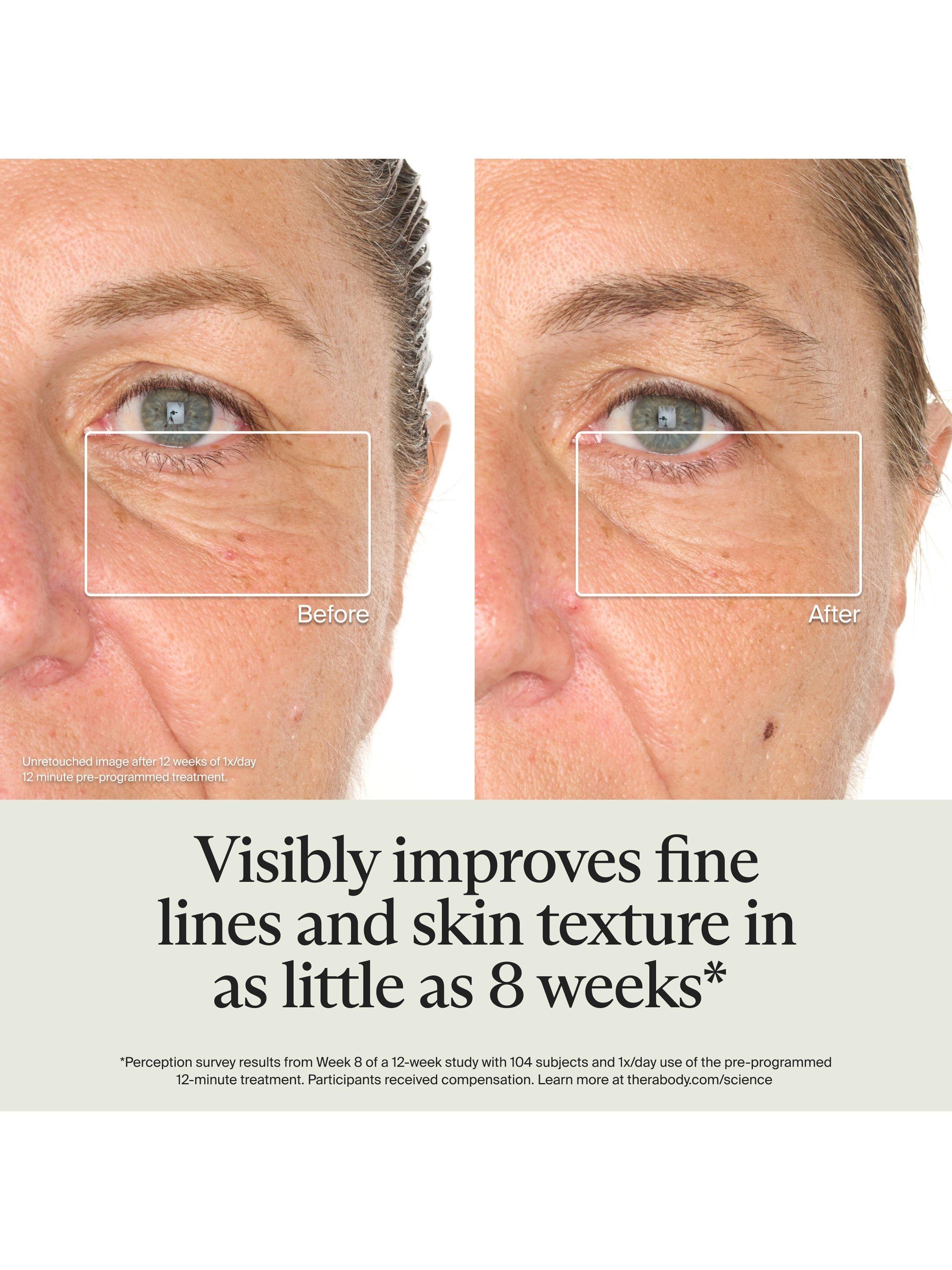 Product image 5 of 9, which shows Therabody TheraFace Mask Glo Cordless LED Skincare Mask with Relaxing Massage