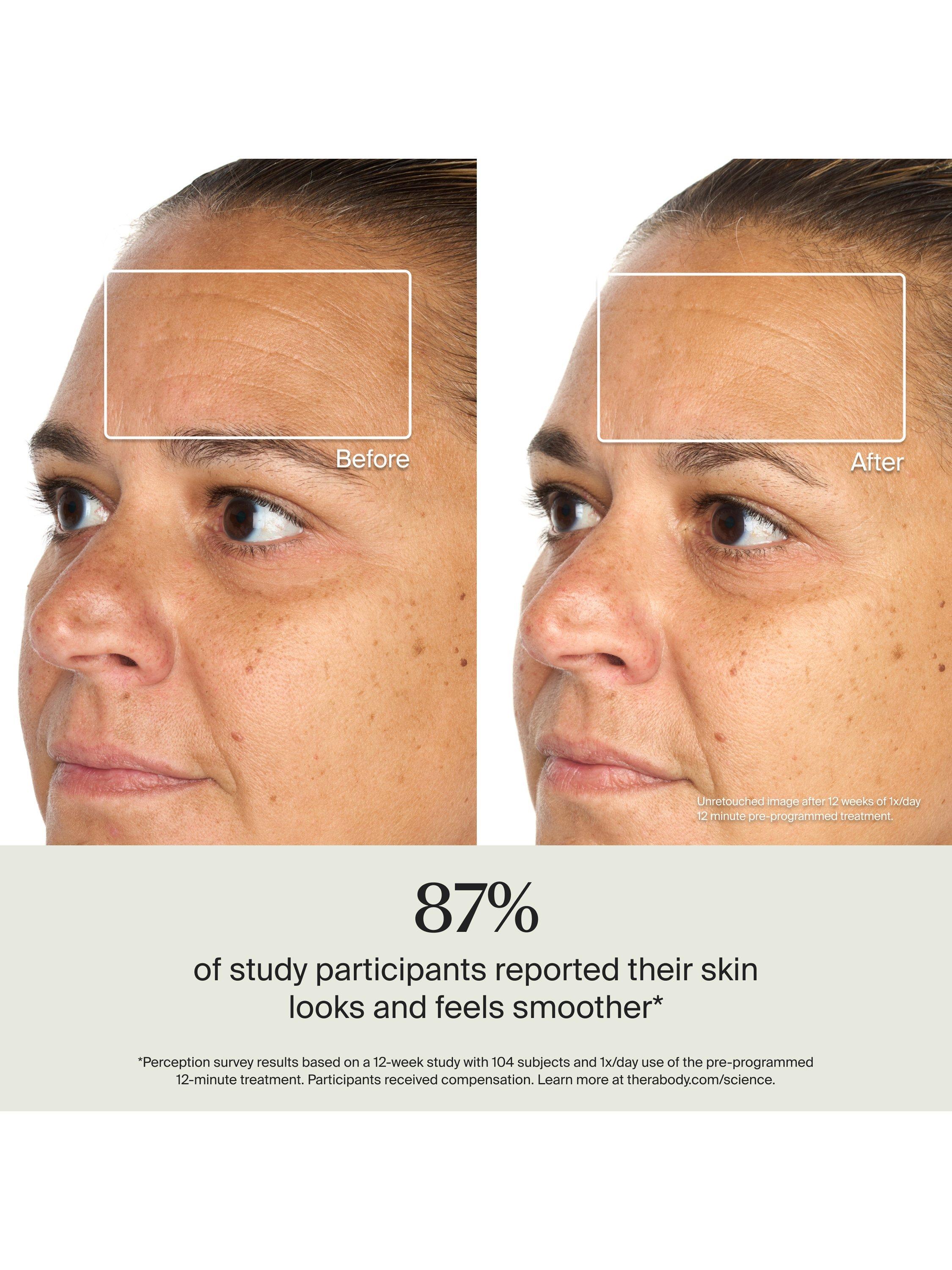 Product image 6 of 9, which shows Therabody TheraFace Mask Glo Cordless LED Skincare Mask with Relaxing Massage