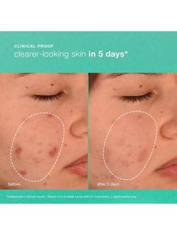 Dermalogica Breakout Biotic Moisturiser, 50ml - view 2, 