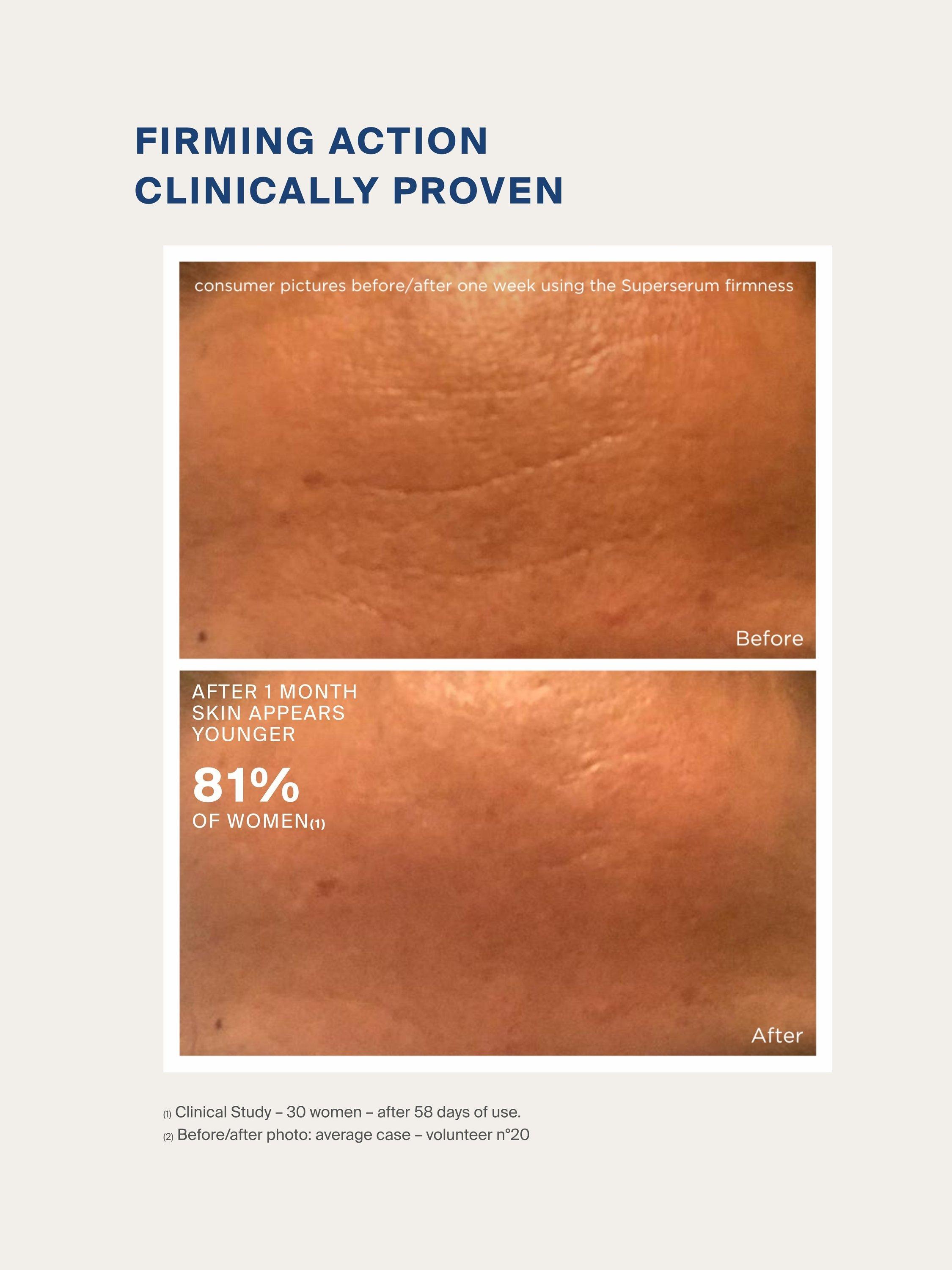 Product image 4 of 7, which shows myBlend Firming Superserum, 15ml