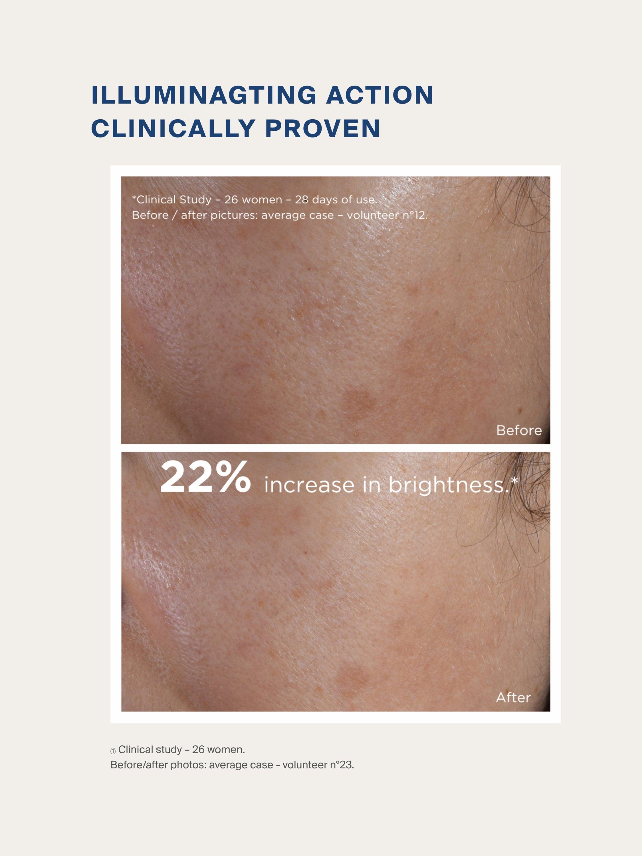 Product image 4 of 7, which shows myBlend Radiance Superserum, 15ml