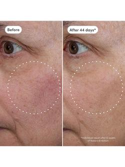 Trinny London Naked Ambition Azelaic Exosome & Vitamin C Serum, 30ml - view 2, 