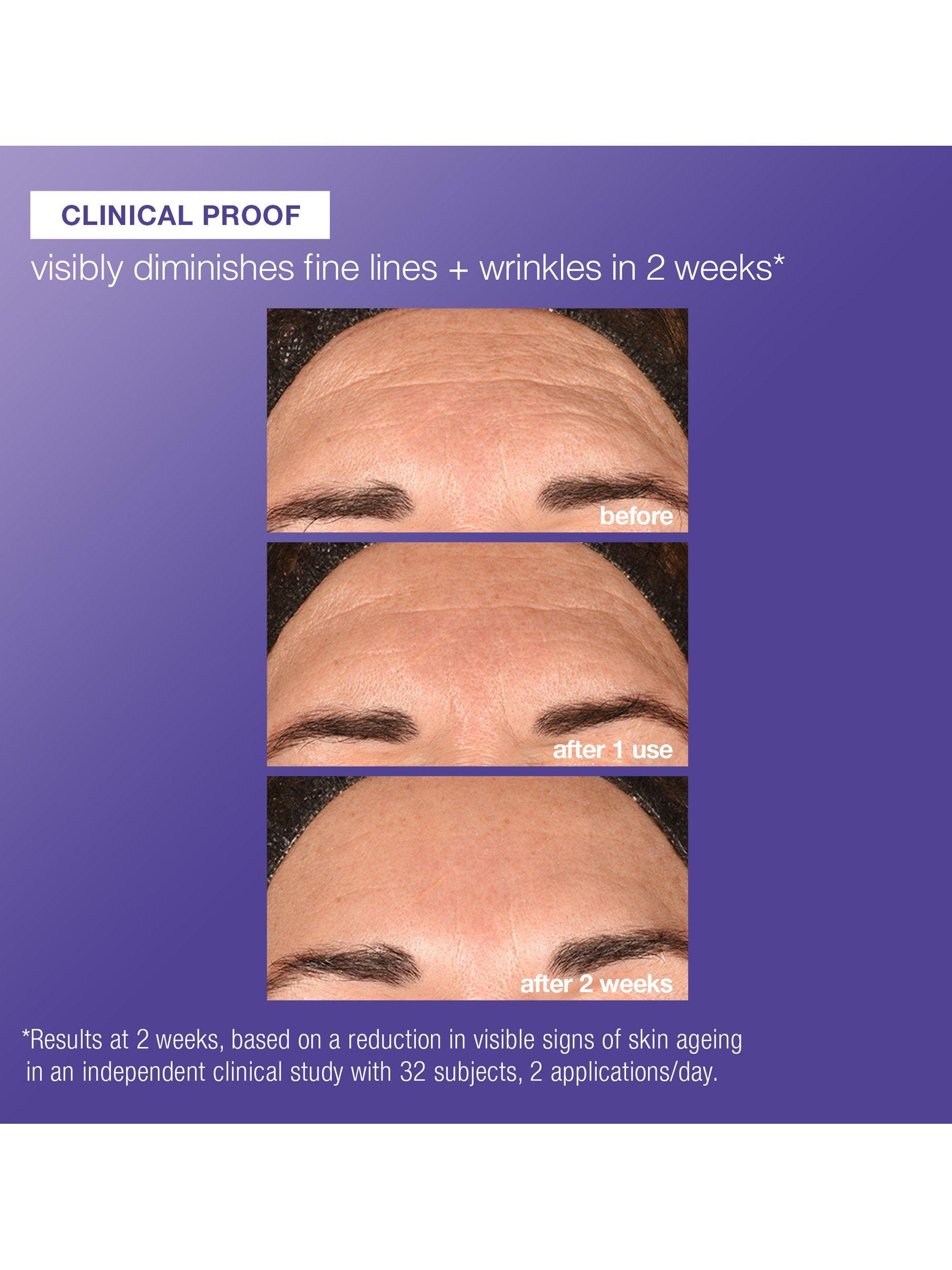 Product image 6 of 11, which shows Dermalogica Phyto Nature E2 Exosome Exfoliant, 100ml