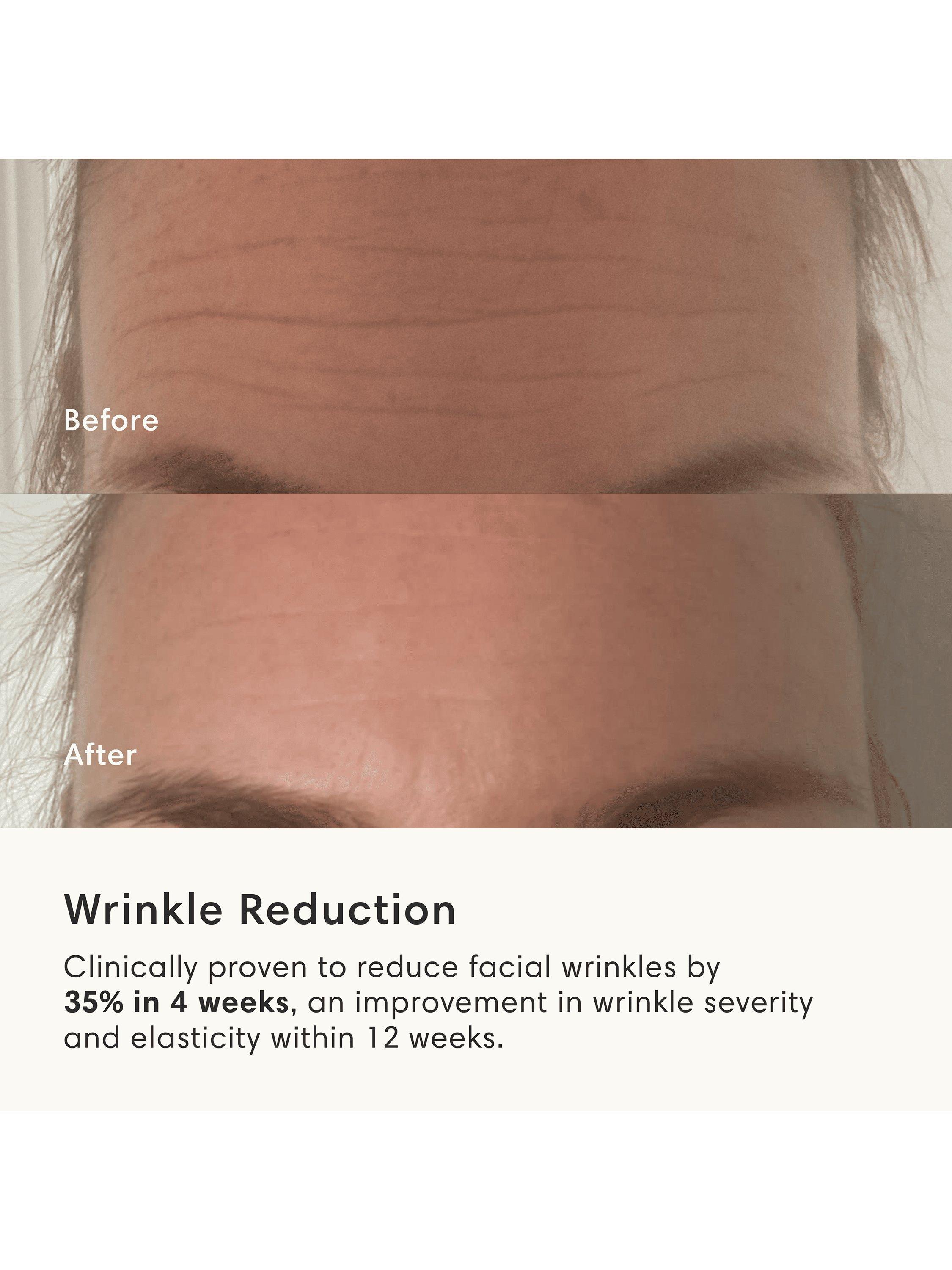 Product image 11 of 11, which shows The Light Salon Boost Portable Professional LED Mask