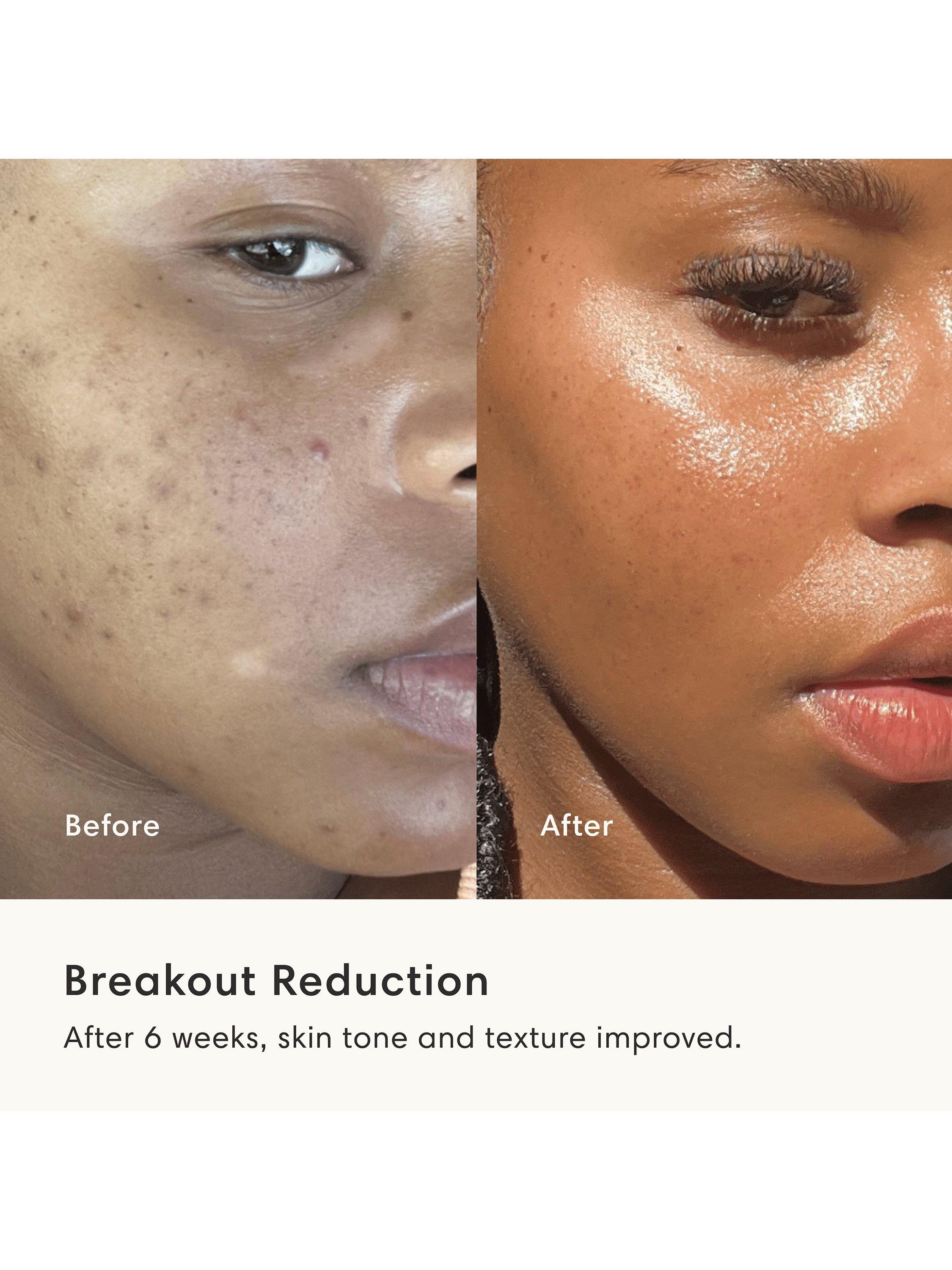 Product image 9 of 11, which shows The Light Salon Boost Portable Professional LED Mask