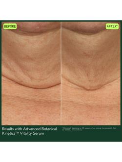 Aveda Advanced Botanical Kinetics Vitality Serum, 30ml - view 2, 