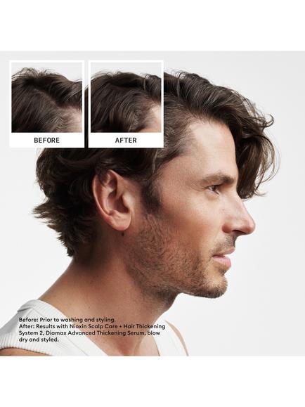 Nioxin System Kit 2 - view 2, Light Blue
