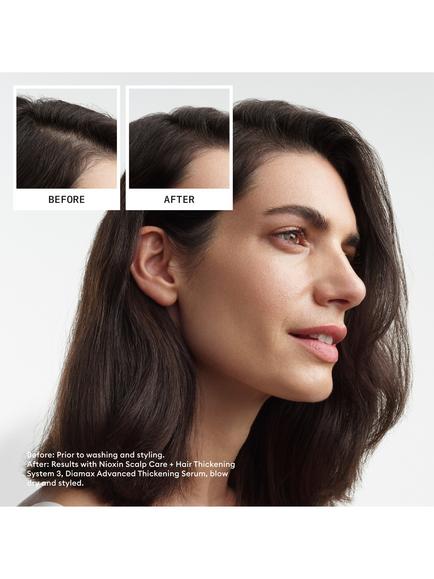 Nioxin System Kit 3 - view 2, Light Blue