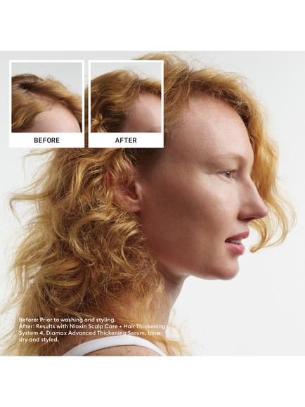 Nioxin System Kit 4 - view 2, Light Blue