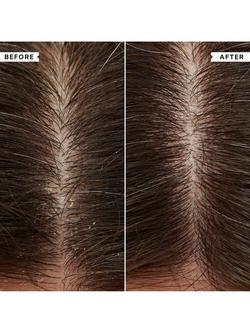 Philip Kingsley Flaky/Itchy Scalp Shampoo - view 2, 