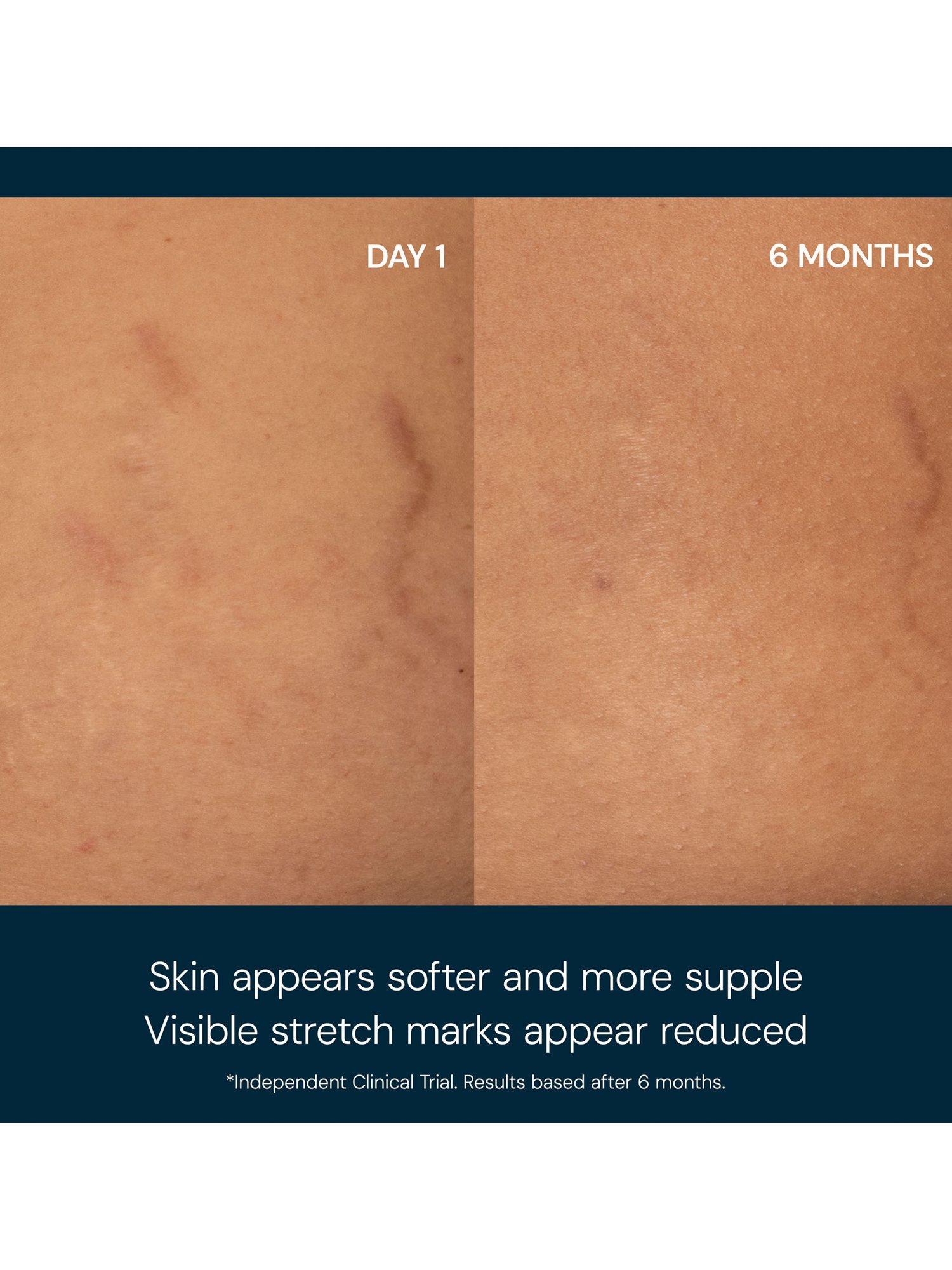 Product image 2 of 8, which shows Elemis Japanese Camellia Oil Body Oil Blend, 100ml