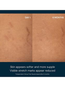 Elemis Japanese Camellia Oil Body Oil Blend, 100ml - view 2, 