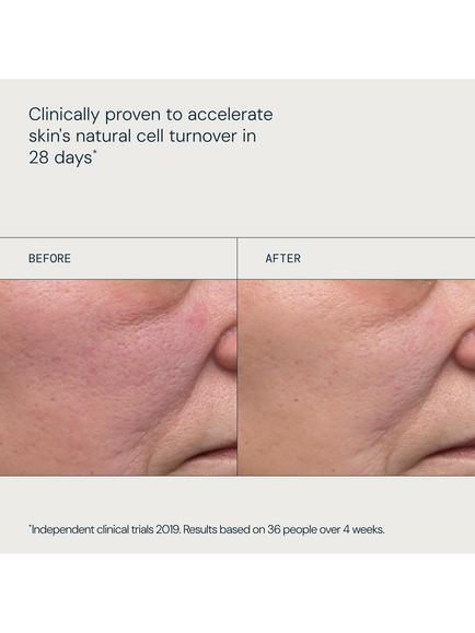 Elemis Dynamic Resurfacing Facial Pads, x 60 - view 2, 