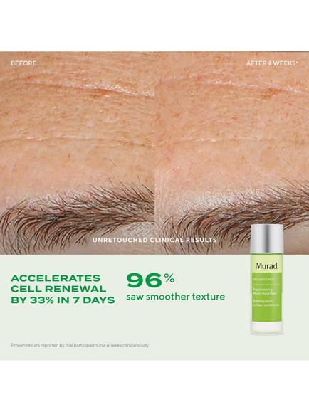 Murad Resurgence Replenishing Multi-Acid Peel, 100ml - view 2, 