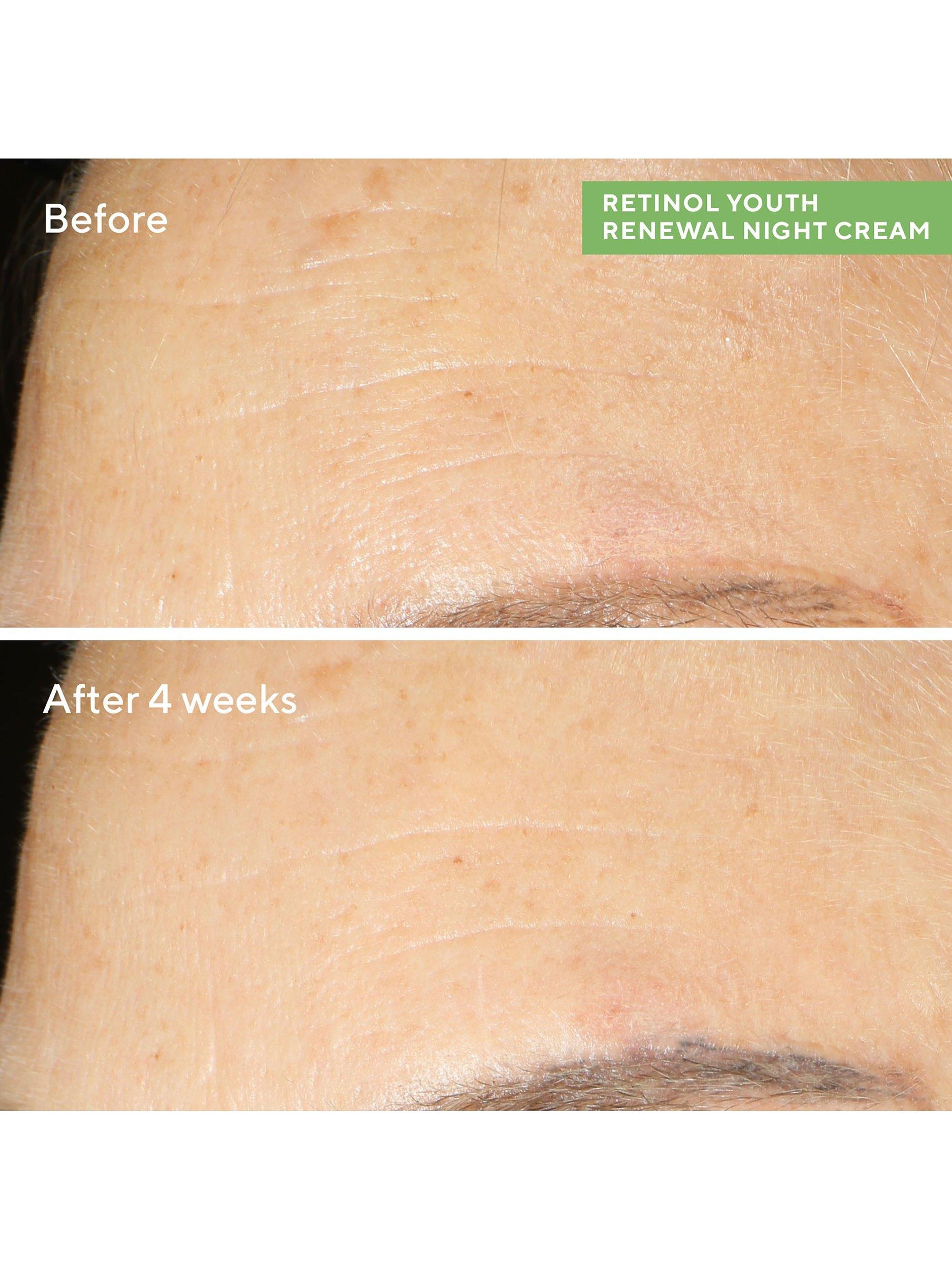 Product image 5 of 9, which shows Murad Retinol Youth Renewal Night Cream, 50ml