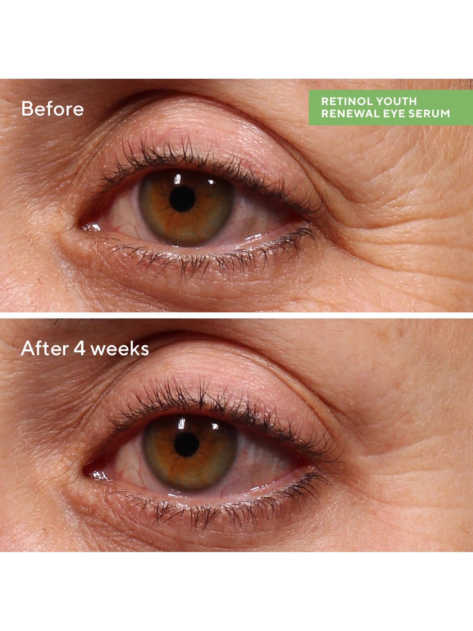 Product image 5 of 9, which shows Murad Retinol Youth Renewal Eye Serum, 15ml