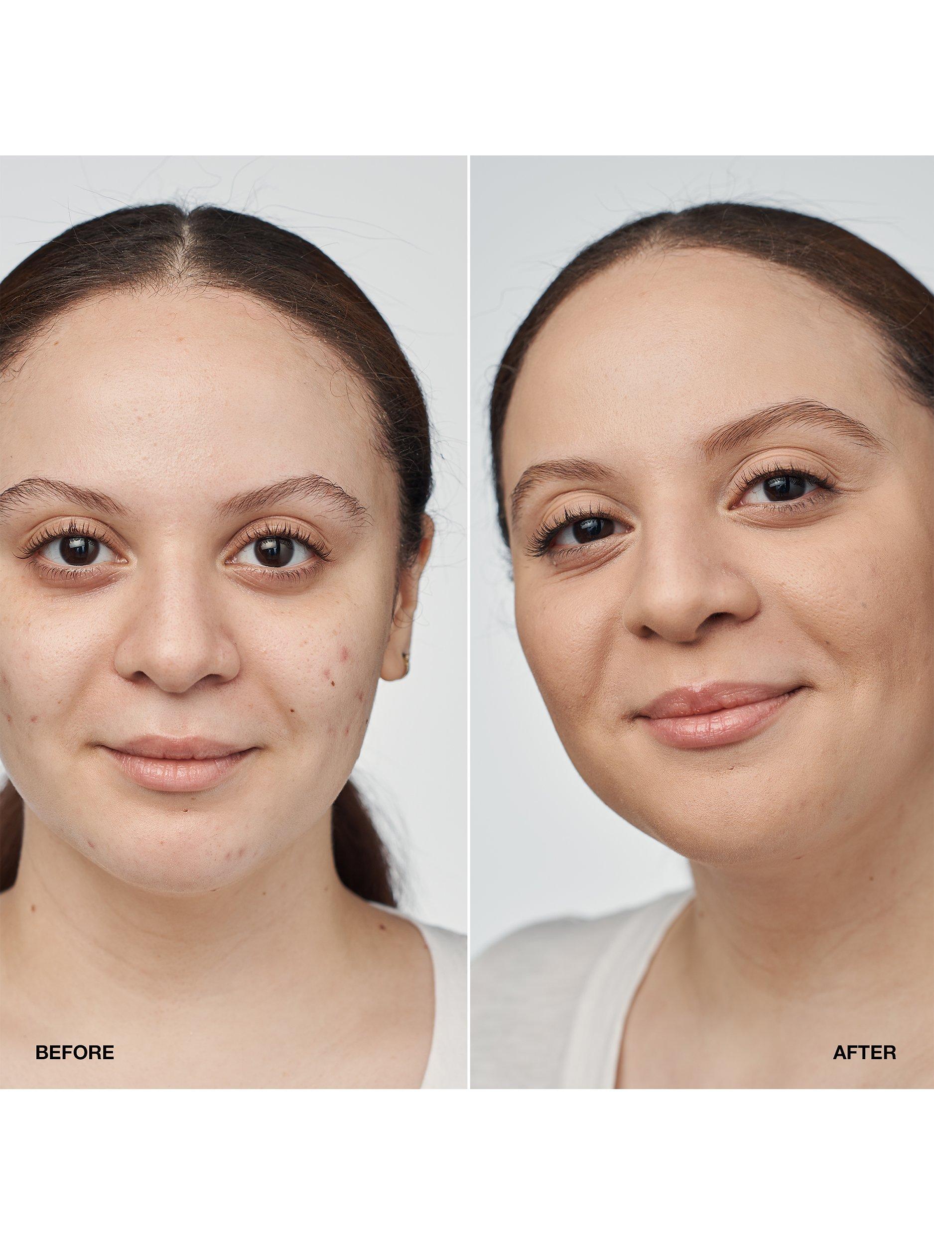 Product image 3 of 8, which shows Clinique Even Better Clinical Serum Foundation SPF 20, CN 52 Neutral