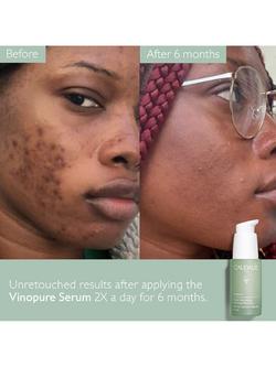 Caudalie Vinopure Blemish Control Salicylic Serum, 30ml - view 2, 