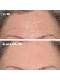 Murad Targeted Wrinkle Corrector, 15ml - view 2, 