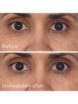 Murad Retinol Youth Renewal Eye Masks, Pack of 5 - view 2, 