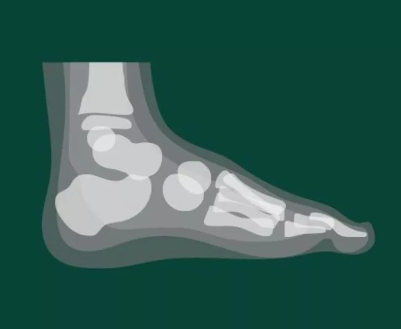 Side view X-ray style illustration of a human foot and ankle bones, medical anatomy graphic on green background