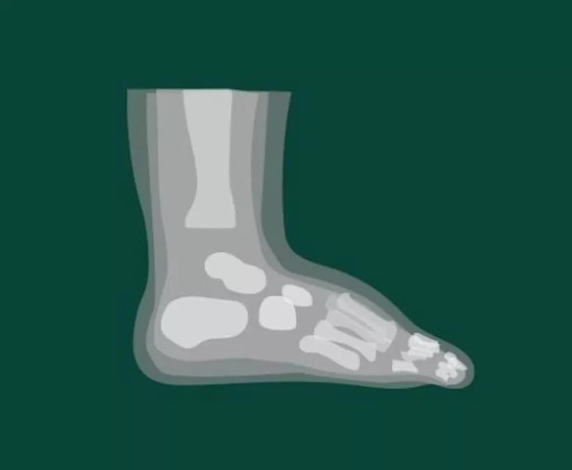 Illustration of an X-ray style side view of a human foot and ankle bones on a dark green background