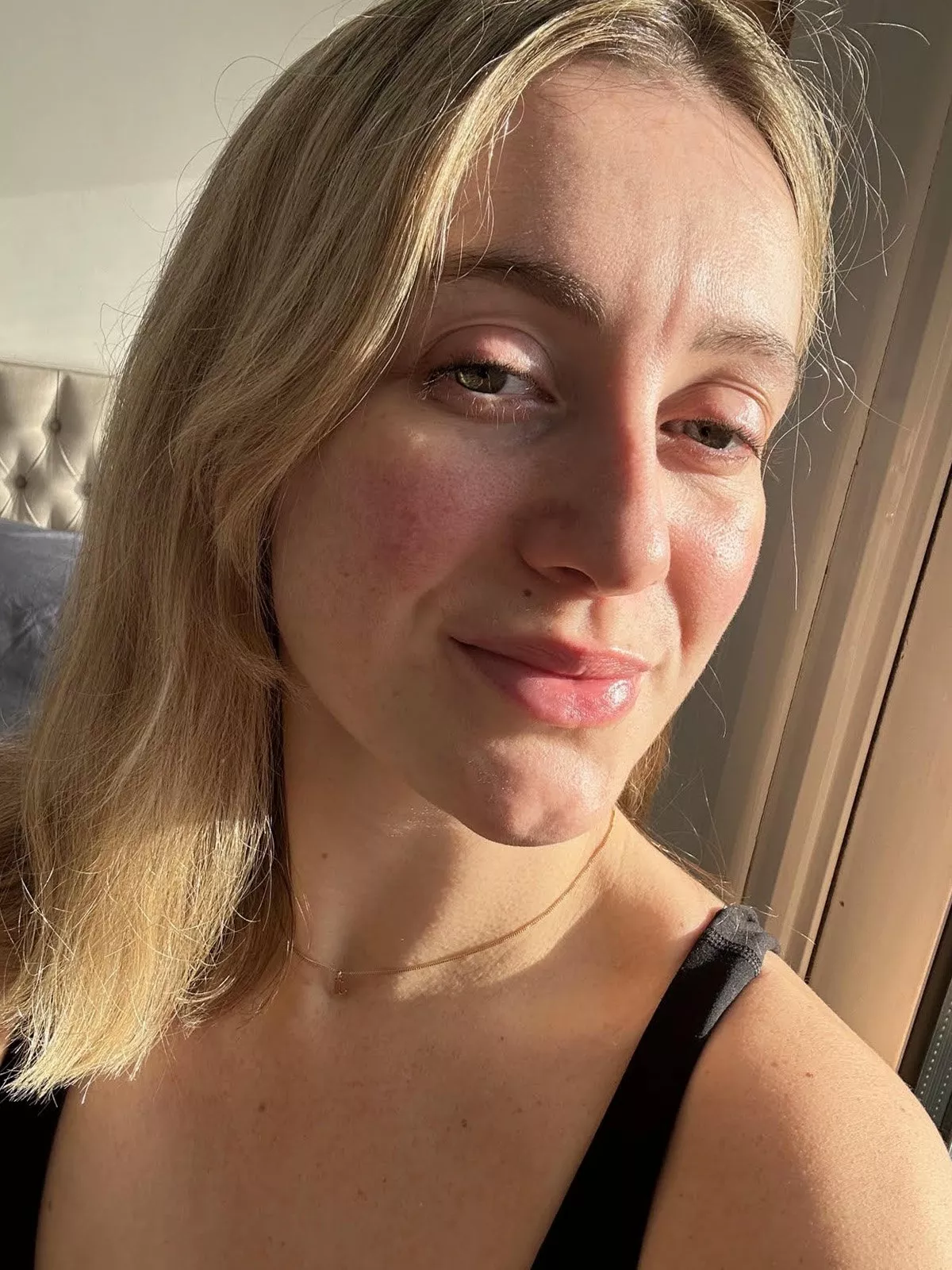 image of a womens face after using shark mask 