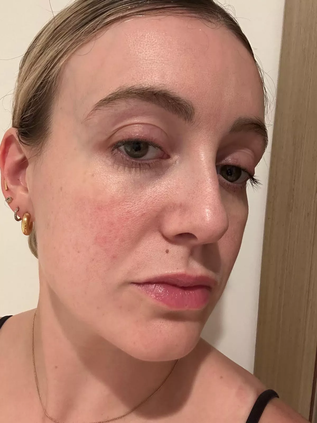 image of a womens face before using shark mask 