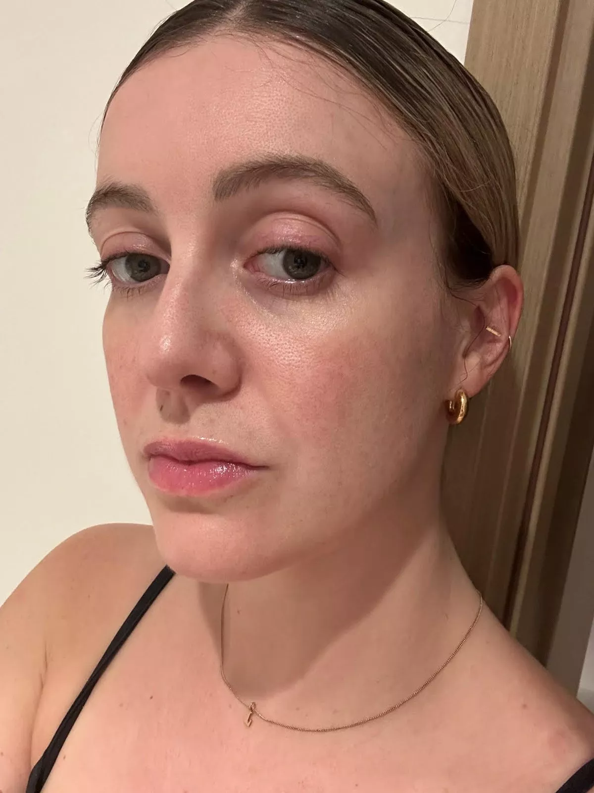 image of a womens face before using shark mask 