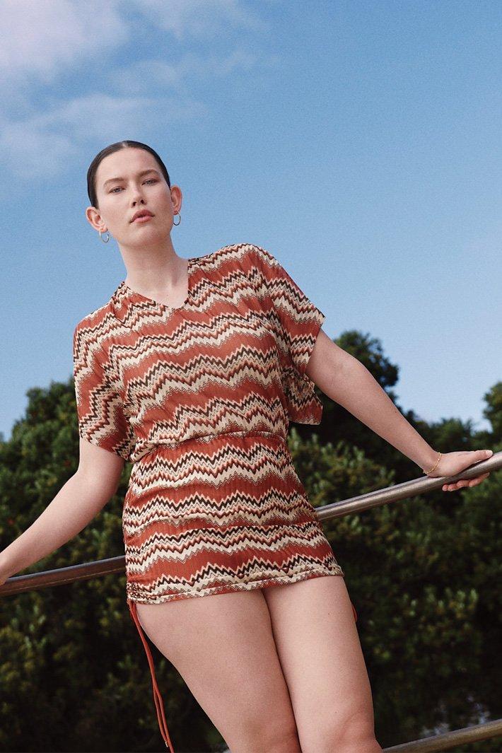 Woman in mini pattern skirt leaning on a rail